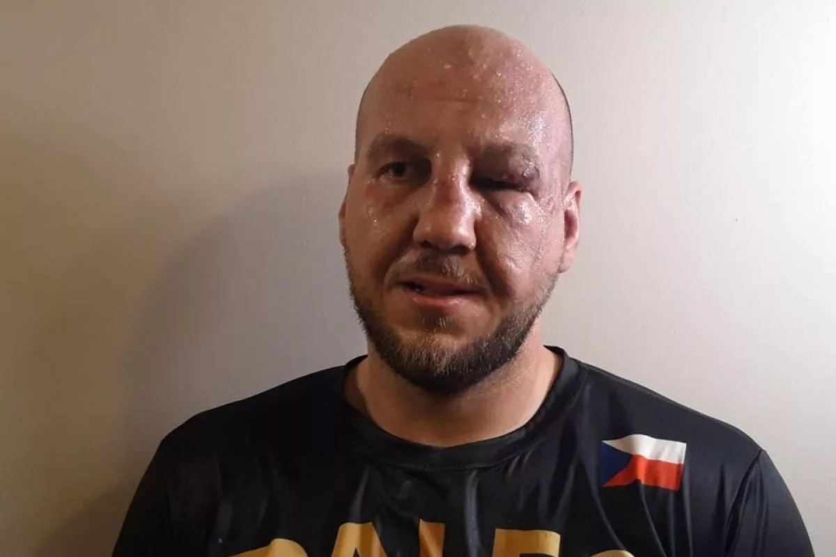 Česká supertěžká váha boxovala se zlomeným nosem a rukou. Daň za titulovou přestřelku