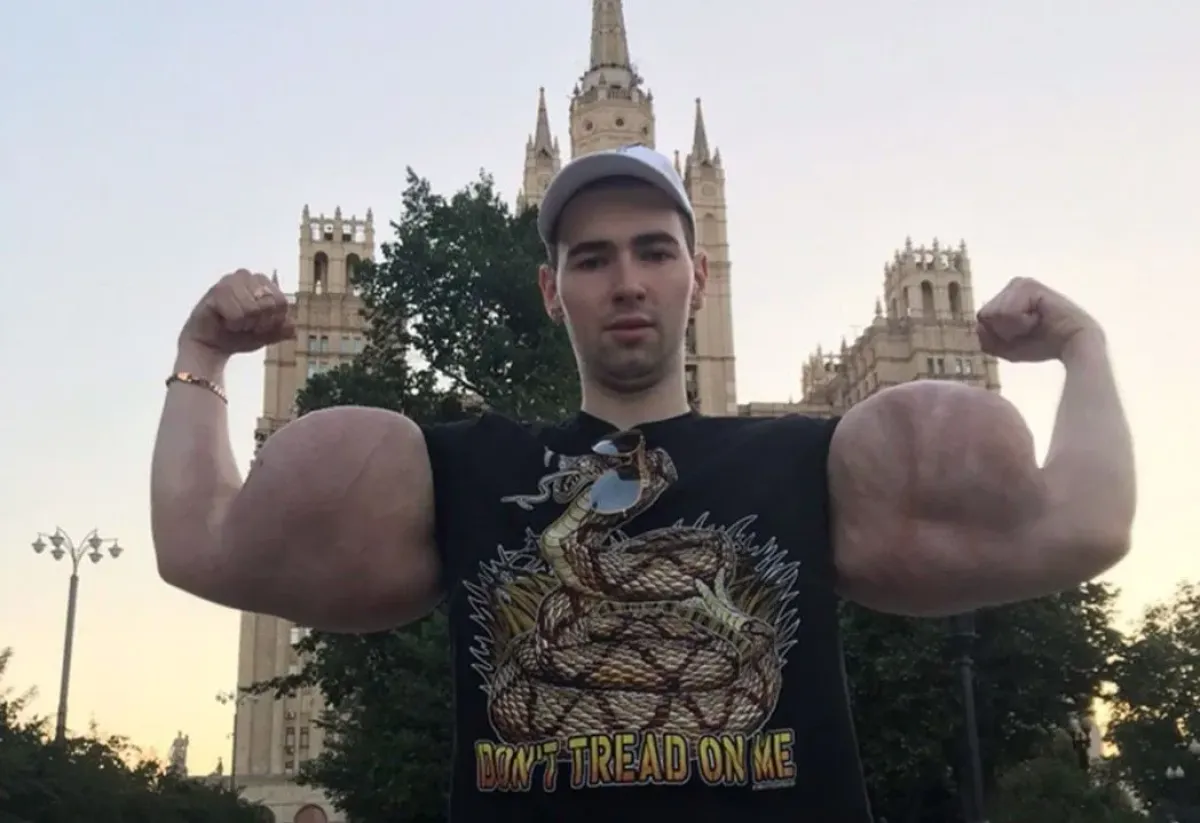 Hazard se životem. Ruský Pepek popírá amputaci rukou