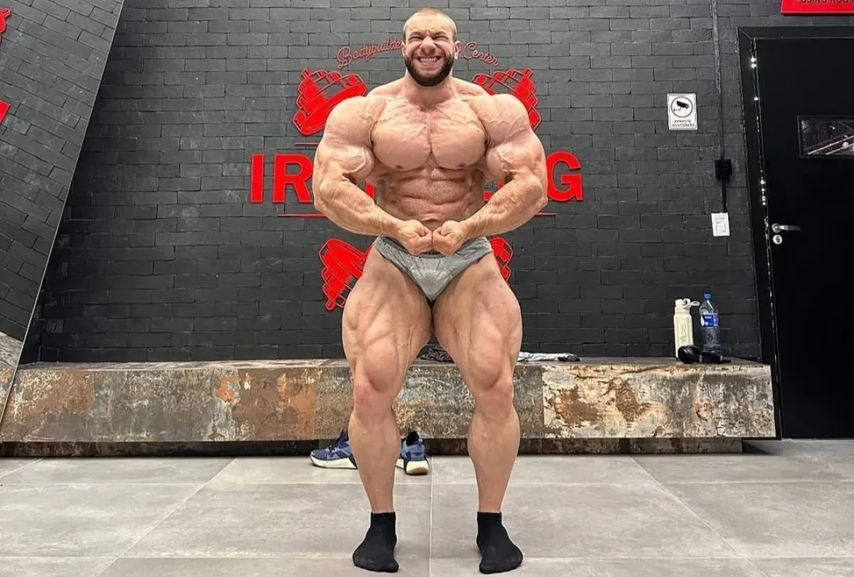 Nalité a žilnaté nohy vyvolaly šokující podívanou. Výjimečné svaly