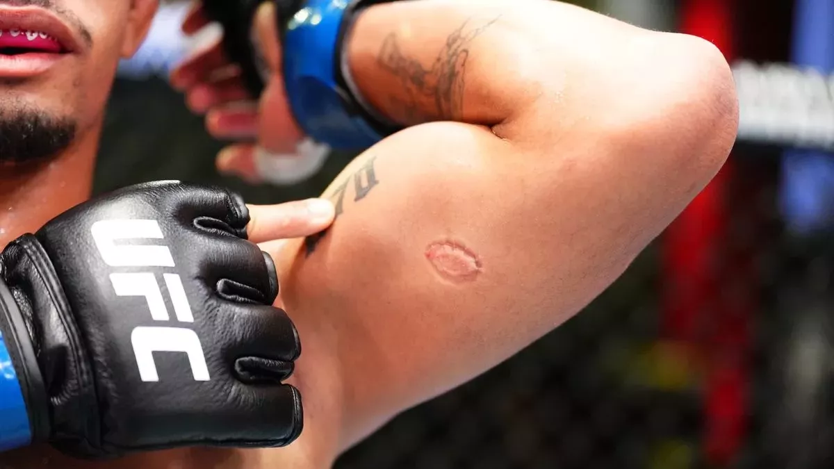 To jsme ještě neviděli! Brazilský bojovník v kleci pokousal soupeře a dostal padáka z UFC