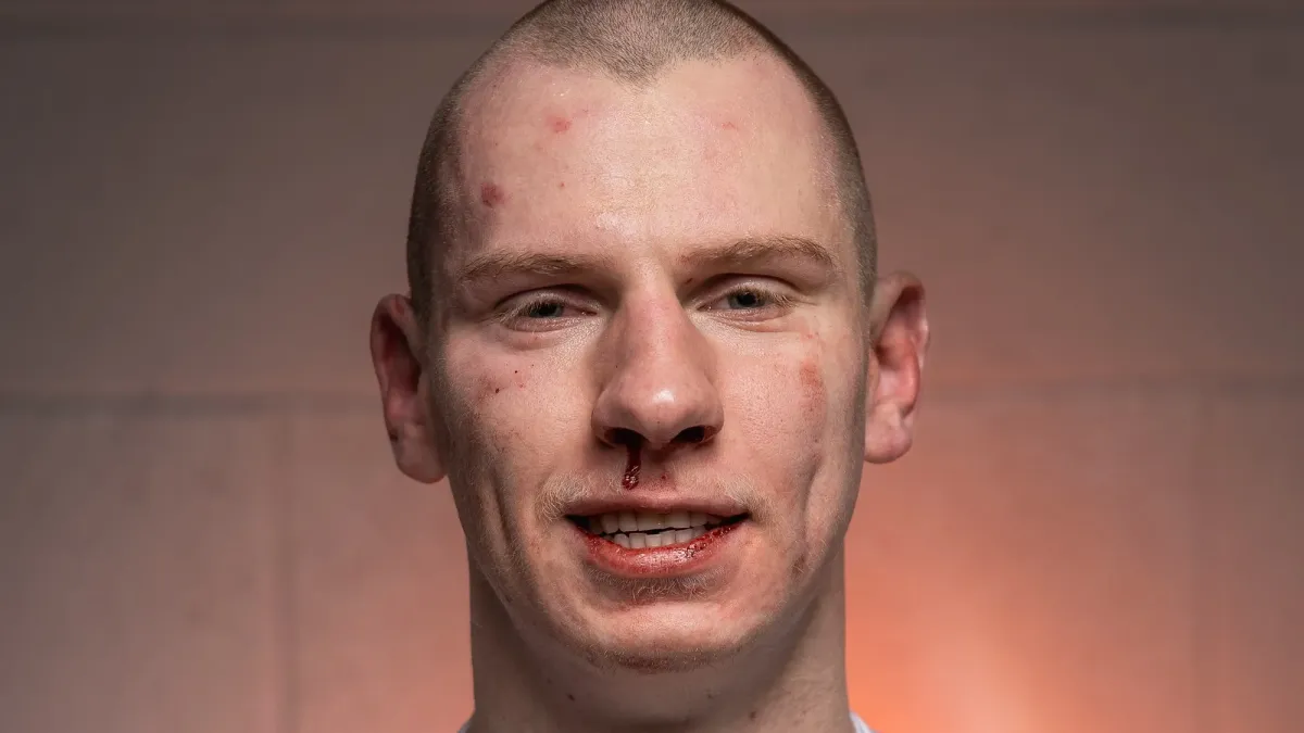 Trenér kritizuje Oktagon kvůli zápasu Spicy Páji: Může být rád, že neskončil na vozíku