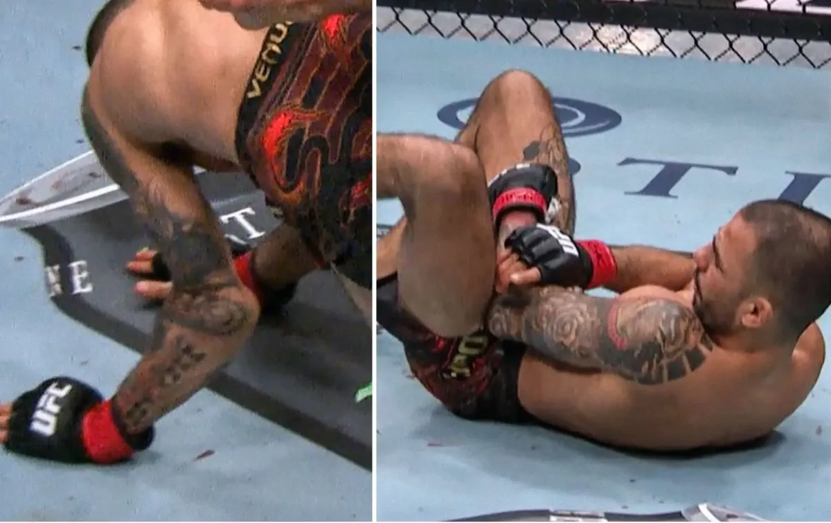 Z toho mrazí. Šampion UFC se nepříjemně zranil, po 26 sekundách přišel o pás