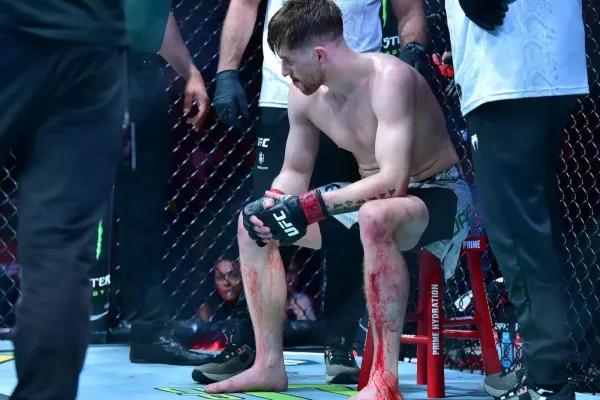 Krvavé tetování zastavilo bitvu v UFC. Otevřená holeň a zásah lékaře