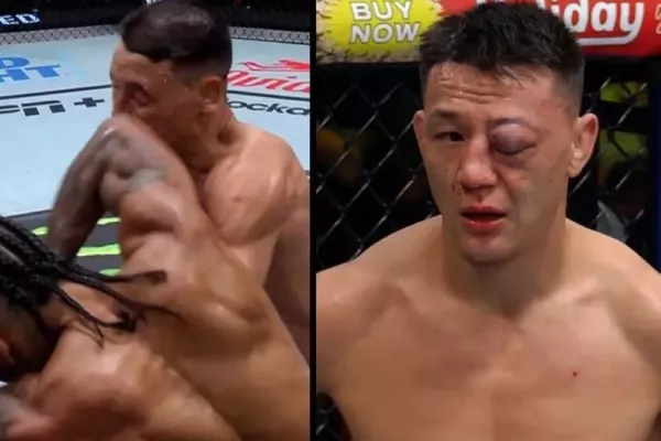 Ostrý loket našel cíl, zdecimoval oko Číňana z UFC. Zasahovat musela doktorka