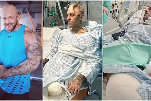 Slovenský MMA zápasník bojuje o život. Přišel o obě nohy i část lebky