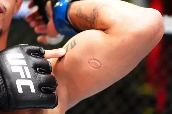 To jsme ještě neviděli! Brazilský bojovník v kleci pokousal soupeře a dostal padáka z UFC