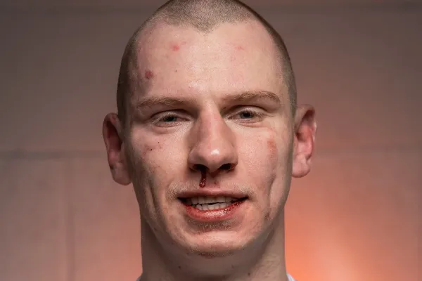 Trenér kritizuje Oktagon kvůli zápasu Spicy Páji: Může být rád, že neskončil na vozíku